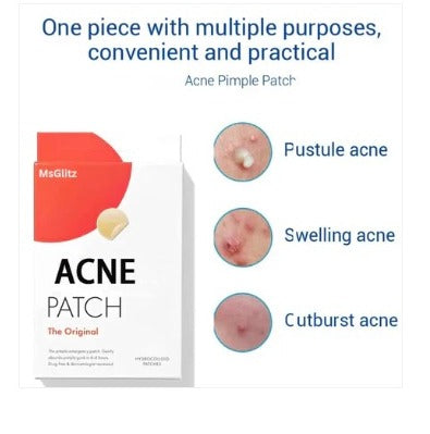 MsGlitz Acne Pimple Patch - Korean Skin Care - Clear - Lab Tested - 36's